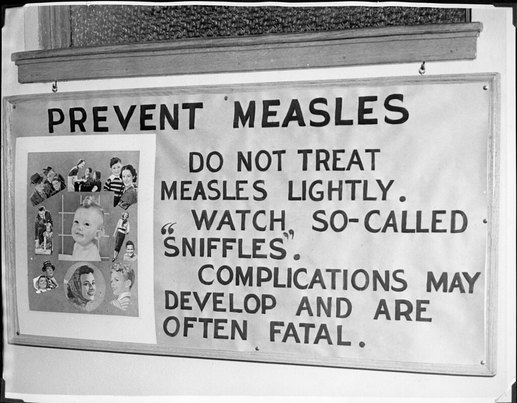 The History of Measles: From Early Epidemics to Modern-Day Prevention ...